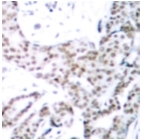 AP01691PU-N - STAT3