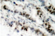 AP01685PU-N - SMC1A / SMC1