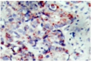 AP01678PU-N - MAP2K4