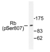 AP01677PU-N - Retinoblastoma-associated protein / RB1