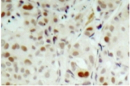 AP01677PU-N - Retinoblastoma-associated protein / RB1