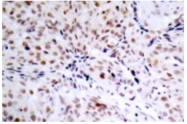 AP01676PU-N - Retinoblastoma-associated protein / RB1