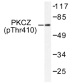 AP01667PU-N - PRKCZ