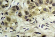 AP01891PU-N - Nibrin