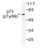 AP01664PU-N - Tumor protein p73 (TP73)