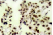 AP01664PU-N - Tumor protein p73 (TP73)