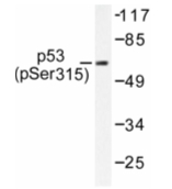 AP01657PU-N - TP53 / p53