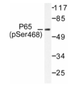 AP01648PU-N - RELA / NF-kB p65