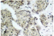AP01635PU-N - MAP2K3