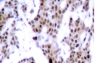 AP01632PU-N - MEF2A