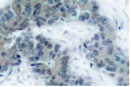 AP01621PU-N - Tyrosine-protein kinase JAK2