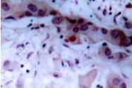 AP01620PU-N - Tyrosine-protein kinase JAK1
