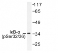 AP01617PU-N - NFKBIA / IKBA