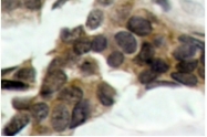 AP01617PU-N - NFKBIA / IKBA
