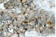 AP01615PU-N - CD61 / ITGB3