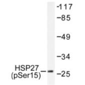 AP01607PU-N - HSPB1 / HSP27