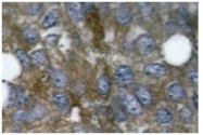 AP01607PU-N - HSPB1 / HSP27