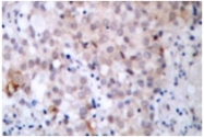 AP01600PU-N - CD340 / ERBB2 / HER2