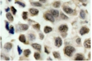 AP01599PU-N - HDAC8