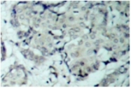 AP01598PU-N - HDAC5