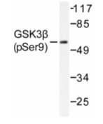 AP01596PU-N - GSK3 beta