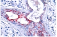 AP01596PU-N - GSK3 beta