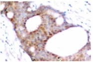 AP01594PU-N - GSK3 alpha