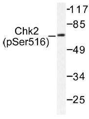 AP01555PU-N - CHK2