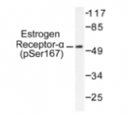 AP01584PU-N - Estrogen receptor alpha
