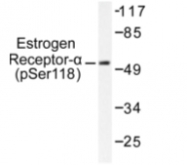 AP01583PU-N - Estrogen receptor alpha