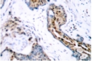 AP01583PU-N - Estrogen receptor alpha