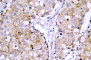 AP01890PU-N - EGFR / ERBB1