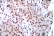AP01581PU-N - Estrogen receptor alpha