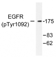 AP01576PU-N - EGFR / ERBB1
