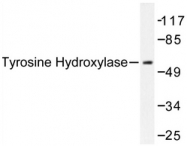 AP06586PU-N - Tyrosine 3-monooxygenase (TH)