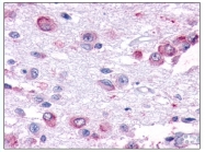 TA341166 - GPR101