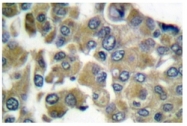 AP06197PU-N - Cytokeratin 16