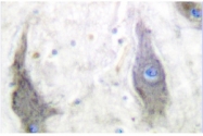 AP06144PU-N - GLUT1 / SLC2A1