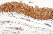 AM09018PU-N - Heat Shock Protein 90 / HSP90