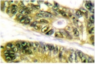 AP06160PU-N - HDAC6