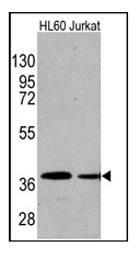 AM11015SU-N - Actin beta / ACTB