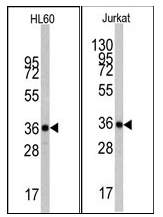 AM11016PU-N - Actin beta / ACTB