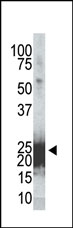 AM11017PU-N - Bcl-2-like 8