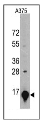 AM11026SU-N - Galectin-1