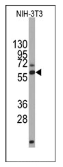 AM11031SU-N - DPYSL2 / CRMP2