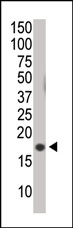 AM11034PU-N - Histone H3
