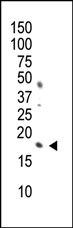 AM11035PU-N - Histone H3