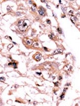 AP15297PU-N - PPP3CC / CALNA3
