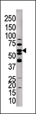 AP15296PU-N - PPP3CC / CALNA3