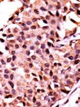AP15296PU-N - PPP3CC / CALNA3